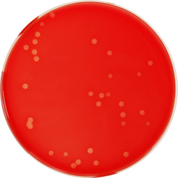 Pp0209 - Blood Base Agar With 5% Defibrinated Sheep Blood - E & O 