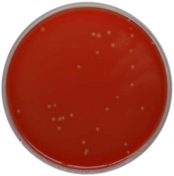 PP3007 - CLED Agar / Primary UTI Chromogenic Agar (Opaque) - E & O ...