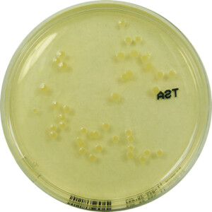 PP1420 - Baird Parker Agar with 5% Egg Yolk Tellurite - E & O ...