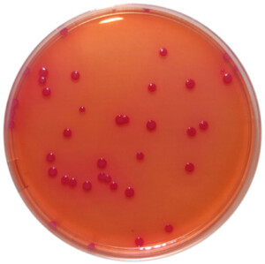 PP1420 - Baird Parker Agar with 5% Egg Yolk Tellurite - E & O ...