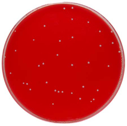 Columbia Agar Base with 7% Defibrinated Horse Blood & CNA Selective ...