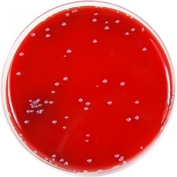 PP1500 - Fastidious Anaerobe Agar (FAA) with 7% Defibrinated Horse ...