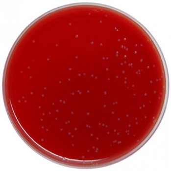 PP1561 - Fastidious Anaerobe Agar (FAA) with 5% Defibrinated Sheep ...