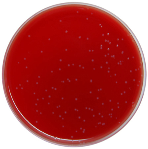 Fastidious Anaerobe Agar (FAA) with 5% Defibrinated Sheep Blood – E & O ...