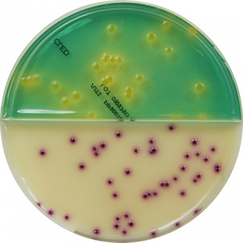 PP3007 - CLED Agar / Primary UTI Chromogenic Agar (Opaque) - E & O ...