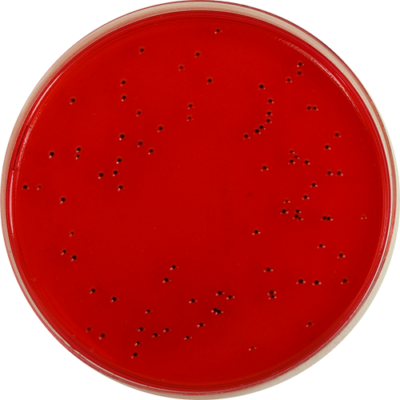 Xylose Lysine Deoxycholate (XLD) Agar with Novobiocin (22.2mg/L) – E ...