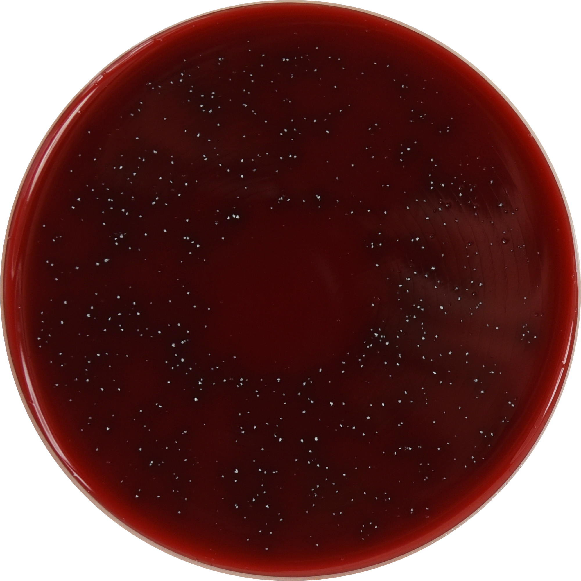 Actinomyces Agar 25ml E O Laboratories Ltd