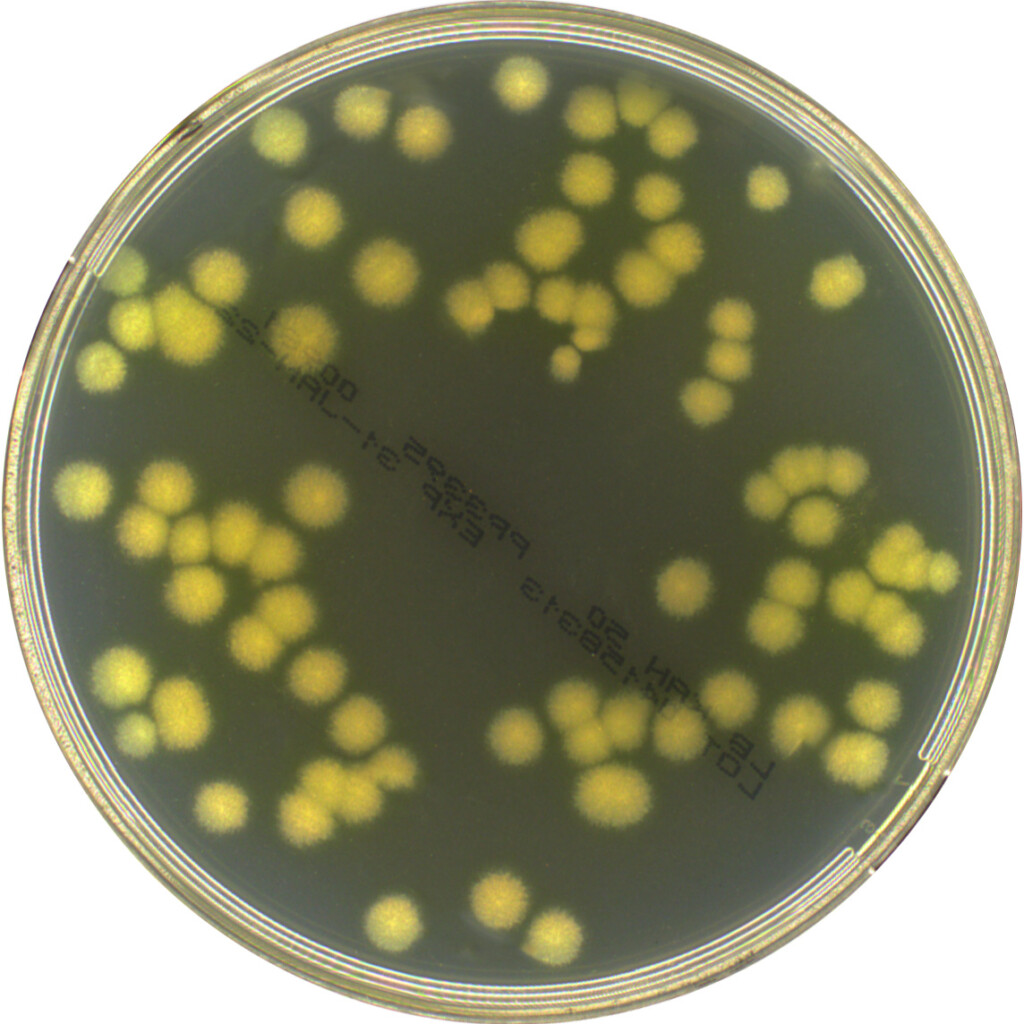 LB Agar (Lennox) with Kanamycin (50mg/L) – E & O Laboratories Ltd