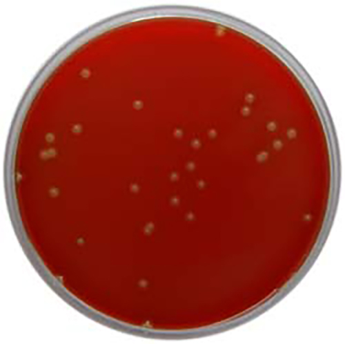 Columbia Agar Base with 5% Defibrinated Horse Blood – E & O ...