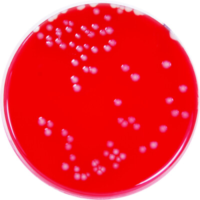 PP0209 - Blood Base Agar with 5% Defibrinated Sheep Blood - E & O ...