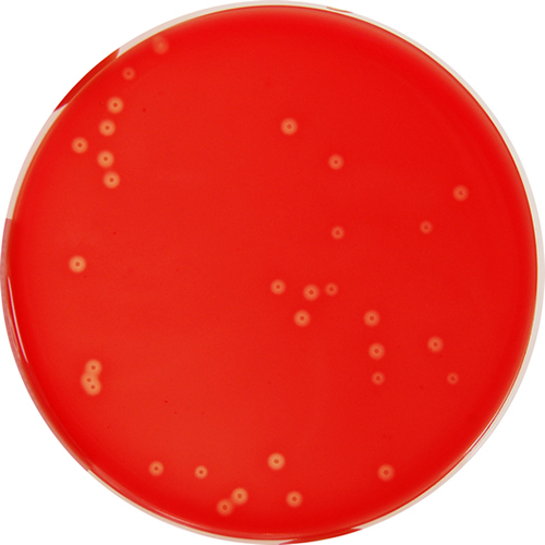 Blood Base Agar with 5% Defibrinated Sheep Blood – E & O Laboratories Ltd