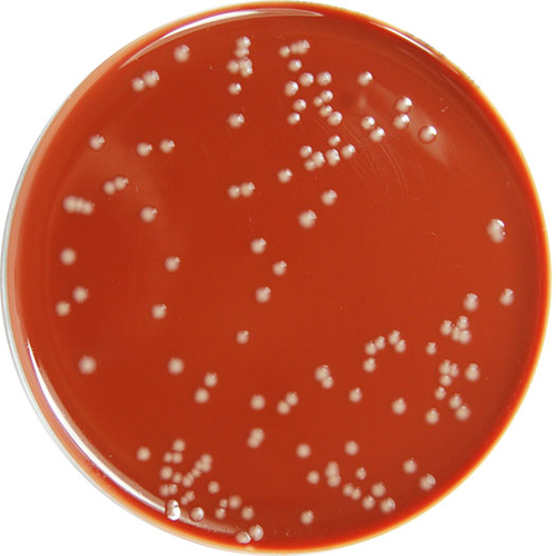 Chocolate Agar & 1% Polyvitex – E & O Laboratories Ltd