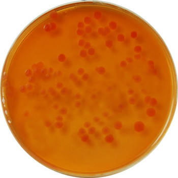 PP0640 - MacConkey Agar - E & O Laboratories Ltd