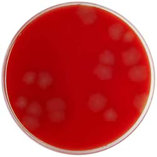 PP1560 - Fastidious Anaerobe Agar (FAA) with 7% Defibrinated Horse ...