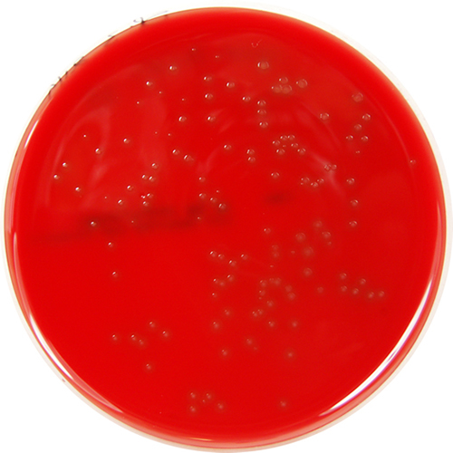 PP1747 - Columbia Agar Base with 5% Defibrinated Sheep Blood - E & O ...