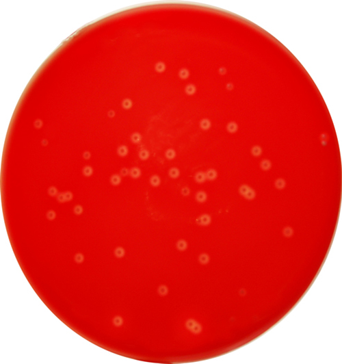 Columbia Agar Base with 5% Defibrinated Sheep Blood – E & O ...