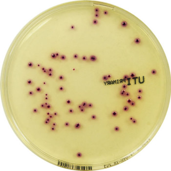 PP3005 - Primary UTI Chromogenic Agar - E & O Laboratories Ltd