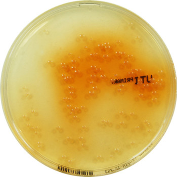 PP3005 - Primary UTI Chromogenic Agar - E & O Laboratories Ltd