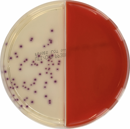 Primary UTI / Columbia Agar with 7% DHB & CNA – E & O Laboratories Ltd